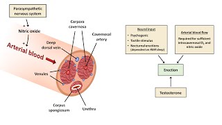 An Approach to Erectile Dysfunction