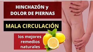 CÓMO ALIVIAR RÁPIDAMENTE LA CIRCULACIÓN DE LAS PIERNAS #varices