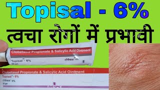 Topisal - 6% Uses in Hindi | Clobetasol Propionate and Salicylic Acid Ointment |