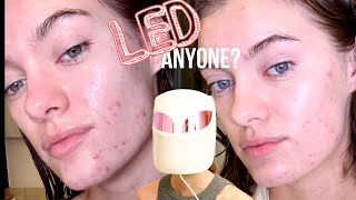 Can skincare be easy? Discovering the LumiVisage LED mask