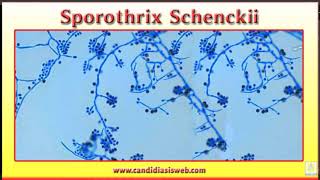 Snippet Lecture: Sporothrix Schenckii