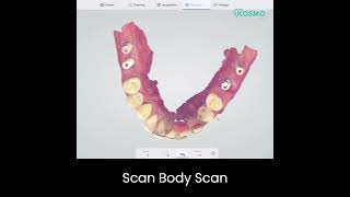 Digital Impressions taken @kosmodentalacademy #digitaldentistry #shorts