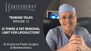 Tehrani Talks Episode 13: Limit of fat for liposuction?