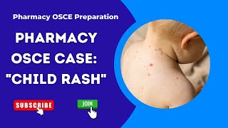 Pharmacy OSCE Cases: How to solve the Child Rash Case? | PEBC | OSCE Cases