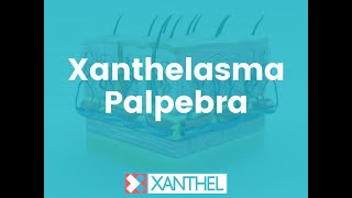 Xanthelasma Palpebra - WHAT IS XANTHELASMA PALPEBRA ? - Brought To You By XANTHEL®