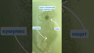 Oocyte-cumulus complex. Ооцит-кумулюсний комплекс. #embrio #ivf #icsi #oocyte #cumulus #biology