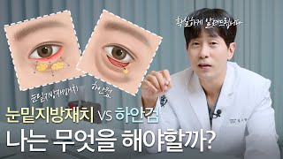 5분만에 고민해결!! 눈밑지방재배치 vs 하안검