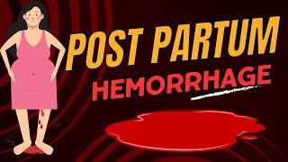 Post Partum Hemorrhage ( PPH) | Risk Factors, Causes and Management