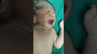 New born #baby#after birth##shorts#newborn#america