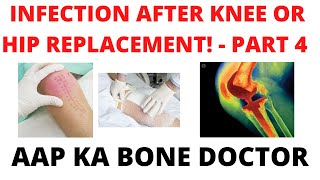 INFECTION AFTER KNEE OR HIP REPLACEMENT - PART 4- EPISODE 5