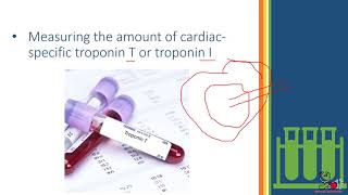 10-Cardiac troponins