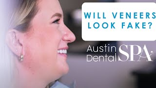 Will  Porcelain Veneers Look Fake? | Austin Dental Spa | Austin, TX | Ph: 512-452-9296