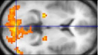 Neurolaw | Wikipedia audio article