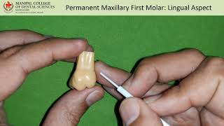 lingual aspect of Permanent maxillary first molar