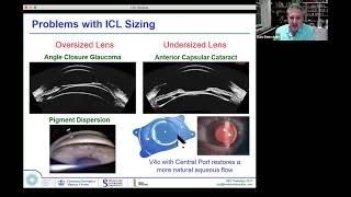 ASCRS Dan Reinstein Arcscan Insight 100 Applications - Raising the Standard Cornea and ICL