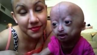 Adalia Rose