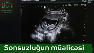 Qadınlarda sonsuzluğun müalicəsi