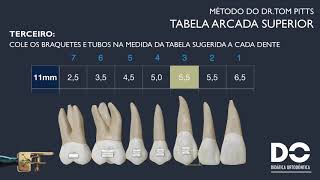 Colagem progressiva, como definir o Smile Arc, Arco do Sorriso