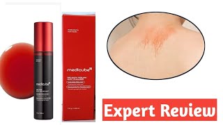 Medicube Red Acne  Body  Peeling Shot Cleanser   Expert Reiew