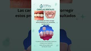 Carillas dentales