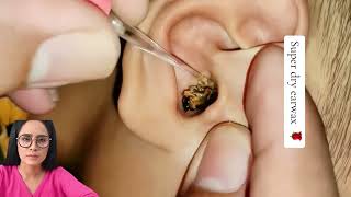 Dr.Natacha, satisfying relaxing asmr video earwax removal.