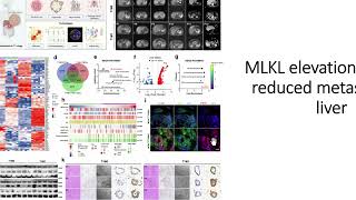 MLKL elevation in PDAC reduced metastasis in liver #Code: 655