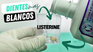 Blanquea tus dientes en 5 dias con LISTERINE  WHITENING