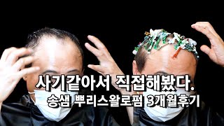 송샘 유투브가 사기처럼 보여서 직접 뿌리스왈로펌해봤습니다. 3개월 솔직후기