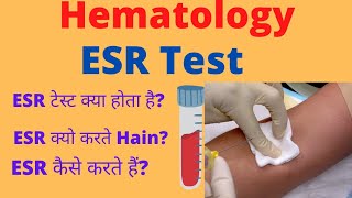 What Is ESR Test// ESR Test कैसे करते Hain..