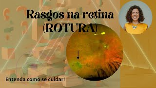 Rotura na retina - Essa lesão pode ser uma emergência!