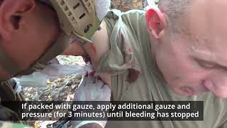 CMC 17 Axillary Junctional Hemorrhage Control Tactical Field Care