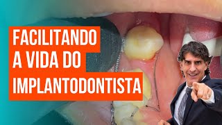 Facilitando a vida do implantodontista!