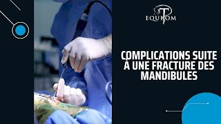 Complications suite à une fracture des mandibules 🦷😓