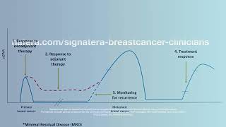 Natera Signatera Product Theater SABCS 2022: ctDNA Utility