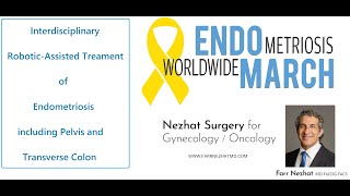 2.  Interdisciplinary Robotic-Assisted Treatment of Endometriosis incl. Pelvis and Transverse Colon