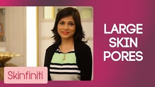 Solution For Large Skin Pores | Skincare | Skinfiniti With Dr.Jaishree Sharad