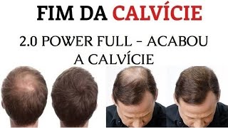 Calvície Resolvida - Queda de cabelo nunca mais - O Guia Definitivo