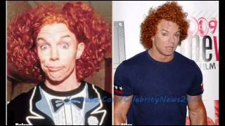 Carrot Top Plastic Surgery Before and After HD