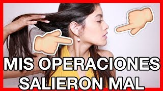 MIS OPERACIONES (ME OPERE LA MANDIBULA Y NARÍZ) - Barbaragrattziani