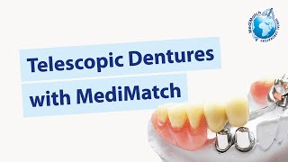 Master Telescopic Dentures with MediMatch