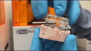 Implant Bar & Screw Retained Structure Prototyping with 3D Printing