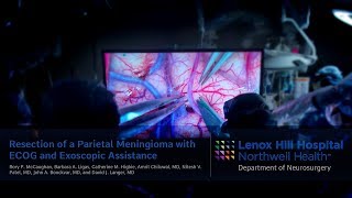 Resection of a Parietal Meningioma with ECOG and Exoscopic Assistance