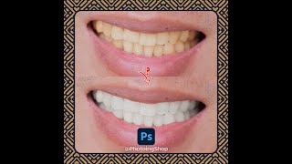 Photoshop Tutorial : How to whiten teeth in Photoshop (best way)