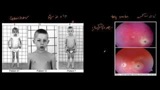 الدهون الاسفنجية - Sphingolipids