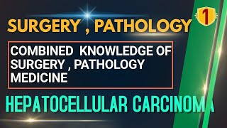 SURGERY 01 : HEPATOCELLULAR CARCINOMA | Malignant Tumor of Liver, PATHOLOGY LECTURE, SURGERY LECTURE