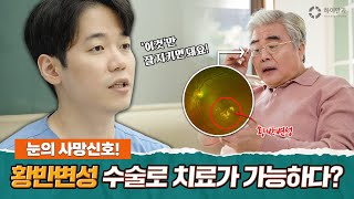 망막전문의가👨‍⚕️ 알려주는 황반변성 예방습관🚨 이대로만 하세요🤙