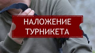 Наложение турникета