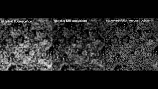 Structured illumination microscopy with unknown patterns and a statistical prior