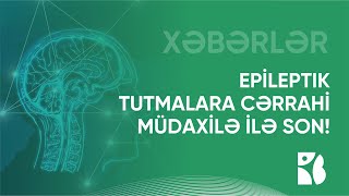 Epileptik tutmalara cərrahi müdaxilə ilə son qoymaq mümkündür!