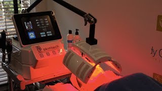 3D Skintech Facial Treatment | Skin Rejuvenation | Facials at The Body Clinic